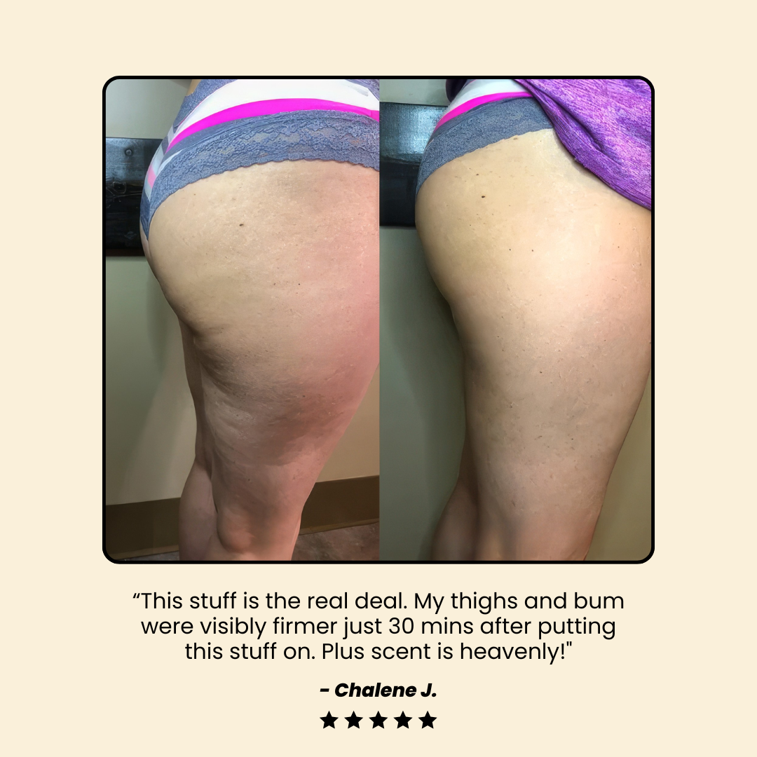 Anti-cellulite Cryo Thermo Firming Gel