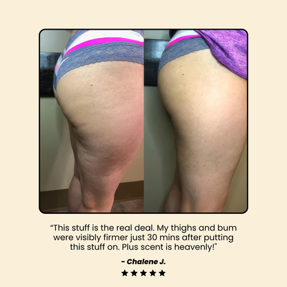 Anti-cellulite Cryo Thermo Firming Gel